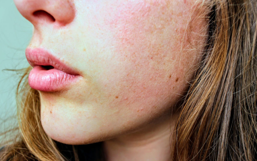 How to Have Glowing Skin All Year Round